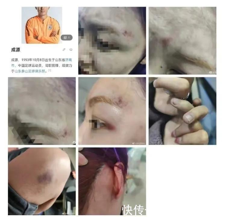 一事件|成源不仅搭上泰山生涯,整个职业生涯也将被毁,严重抹黑中国足球