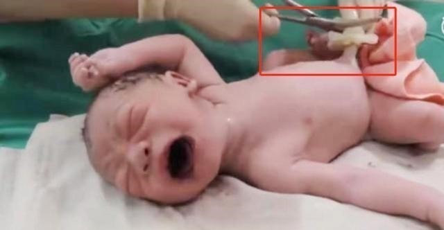 爸爸妈妈|宝宝出生后被带走十几分钟,这段时间经历了什么组图带你看真相!