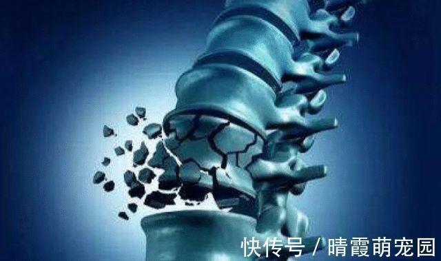 骨质疏松|骨质疏松能不能吃豆腐?86岁骨科院士呼吁:“2绿1白”更要少吃