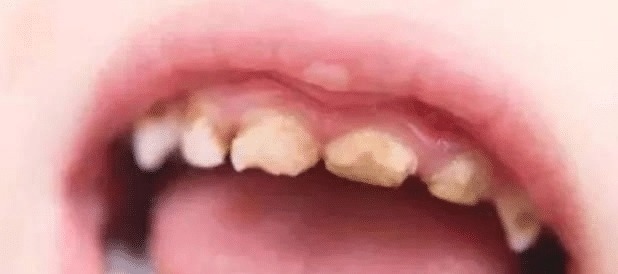 牙齿|如果用牙齿来判断颜值的话,大家觉得问题容易出现在哪里呢?