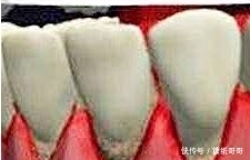 中药|关于有中药成分的牙膏,最近很多对话是酱样子的——