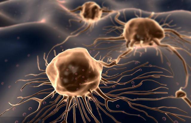 慢性炎症|全球1/6癌症由它引发!国际癌症研究所:2大慢性炎症要及早治