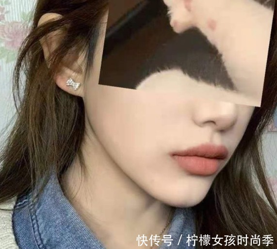 产品|拒绝踩雷!5款祛痘印热门产品,最好用的竟然是它!值得回购N次