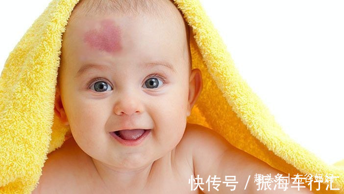 孕期|胎记是怎么来的?产科医生:孕期要避开3种行为,以免宝宝长胎记