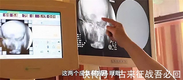 释迦牟尼$2017年,定慧寺将高僧遗体捐赠国家,体检现场显示:大脑还在