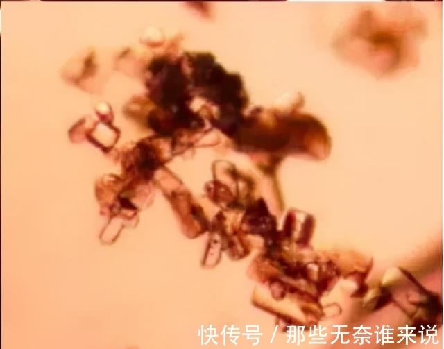 红宝石 宝石科普|绝地武士——尖晶石