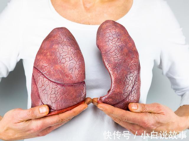 防护|医者不自医专家患癌三年没有复发,关于肺癌防护,他有话要说