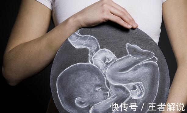 脐带|一听到脐带绕颈四个字,孕妈们就如临大敌,其实起因十分正常