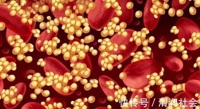 高血脂|甘油三酯大于17界点,暗示血脂超标,3个小妙招快、狠、准