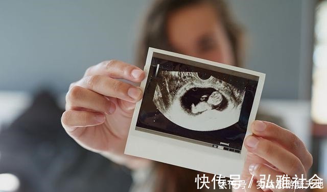 测量|孕期B超单直接反应胎儿状况,这5处孕妈要学会看懂,医生不会详说