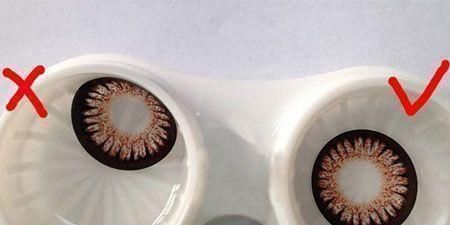 路易斯|女子眼睛不舒服，手术取出27枚隐形镜片，直称“无感觉”