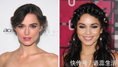 雀斑 即便是整形手术也仍然无法真正改变的8个身体特征