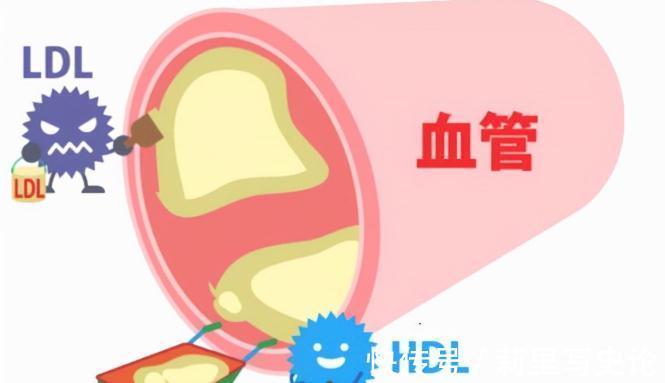 疫苗|“血脂疫苗”正式启用了,每年只需注射两次,什么人都可以打?
