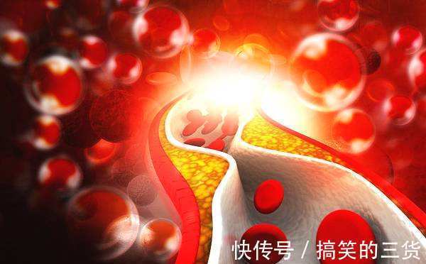 慢性疾病|经常吃“腐乳”的人,会有什么变化或许多数人不清楚,早知早好