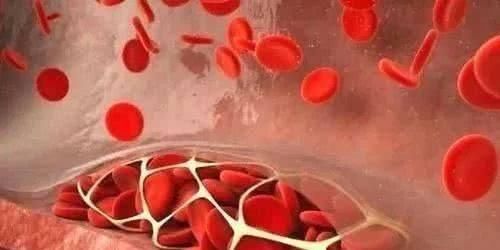 挥发性辣素|天然的“溶栓王”找到了,每天坚持吃点,血管年轻,畅通无阻