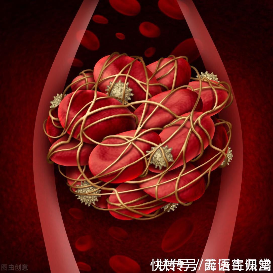 心绞痛|房颤让中风风险增加5倍!学会这2招,帮你的心脏“减减速”