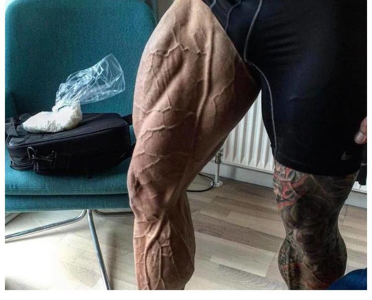 肌肉|俩肌肉小伙健身房PK，次日尿液呈酱油色，练出了肌肉溶解症