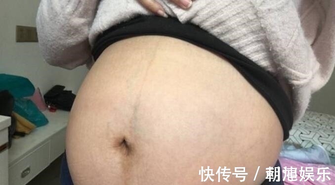 羊水|怀孕后孕妇从这周开始显怀,如果肚脐没有这种表现,说明很有福气