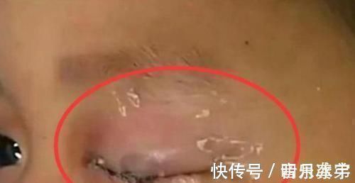 危险物品|孩子误拿502胶水滴眼睛,妈妈30秒内的处理办法,医生都夸奖