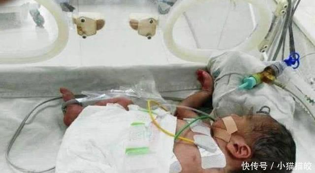 这种血型的妈妈建议只生一个,否则二胎可能引起“新生儿溶血症”