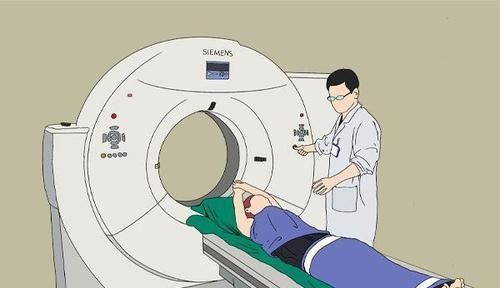 医生|肺鳞癌是怎么来的?呼吸科医生:身体有3大症状,尽早查CT