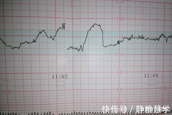 b超|怀孕时,如果准妈妈怀的是女孩,孕检单上一般会有四种提示