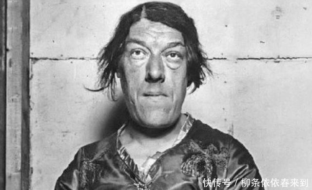 独自|美女突发疾病变成怪物，进马戏团当丑角，独自养育4个孩子