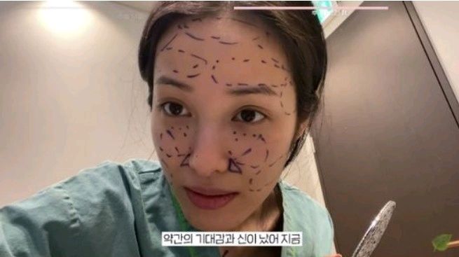 youtuber 韩国离婚女星透露做了隆胸手术和脂肪移植：除了鼻子下巴都整了