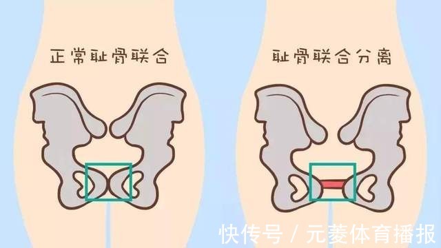 托腹带|生娃对身体影响有多大?奥运冠军吴静钰抱憾离场:生娃后武功全废
