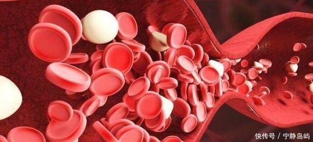 高血压的“源头”被公布,食盐才排第3,第1名很多人都在喝