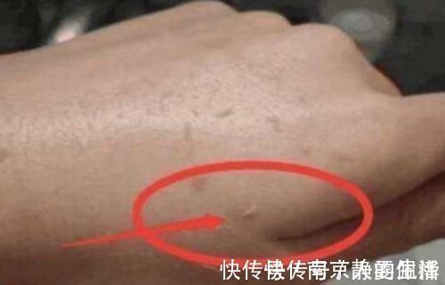 洗澡|在洗澡时,搓出来的“白条”究竟是什么?别傻傻的不懂