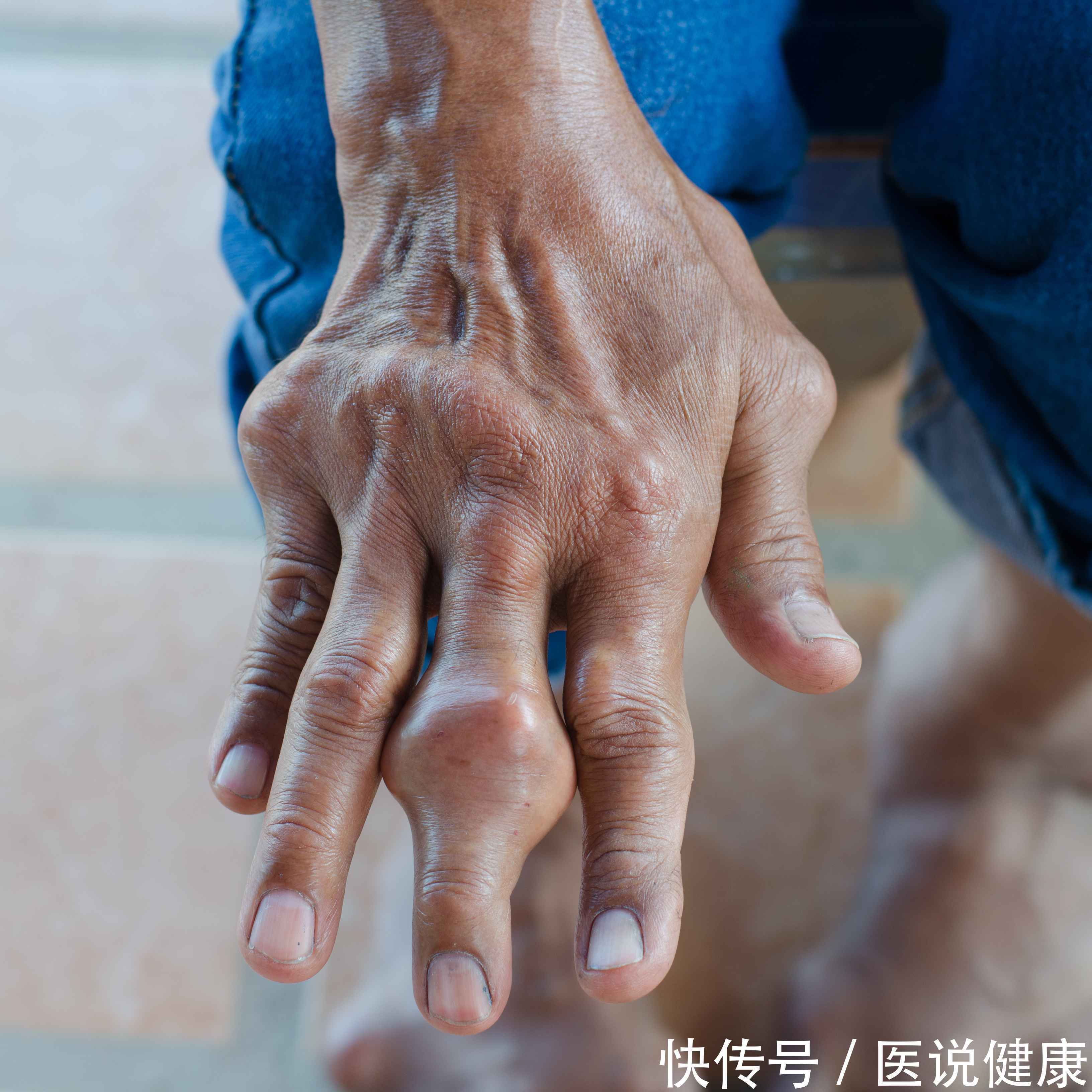 肺部|身体出现这4种情况,要引起重视,肺部或已发生病变,趁早检查