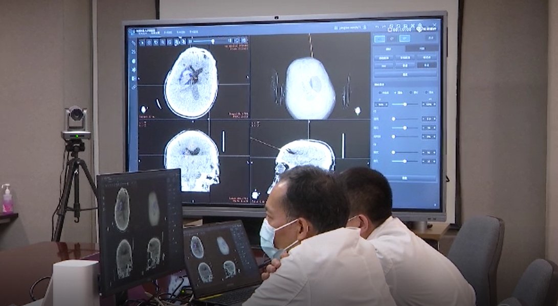 神经外科|“空中”手术室来了 5G+机器人将200公里外血肿清除