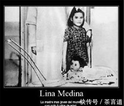 何拉多|医学奇闻:八个月出现生理期,5岁怀孕?孩子到底是怎么生下来的