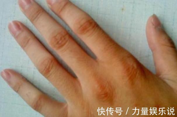 神经末梢|掰手指时会响是为什么？经常掰手指的人，会患上关节炎吗？