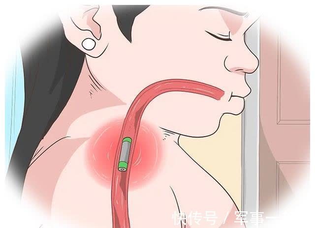 食道|宝宝误食电池严重可致死，要保护孩子一定要做好预防