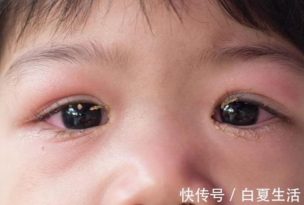 发育|14岁男孩1年长个15CM,医生:坚持做这件事,孩子长高个发育好