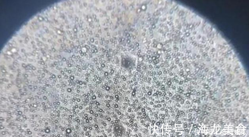 卵巢癌|当母乳被放大1000倍后,在显微镜下轻轻蠕动,纯净得令人难以置信