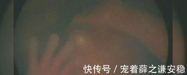 胎儿|腹中胎儿对镜头挥手,其实是求救讯号,医生脸色大变进行紧急手术