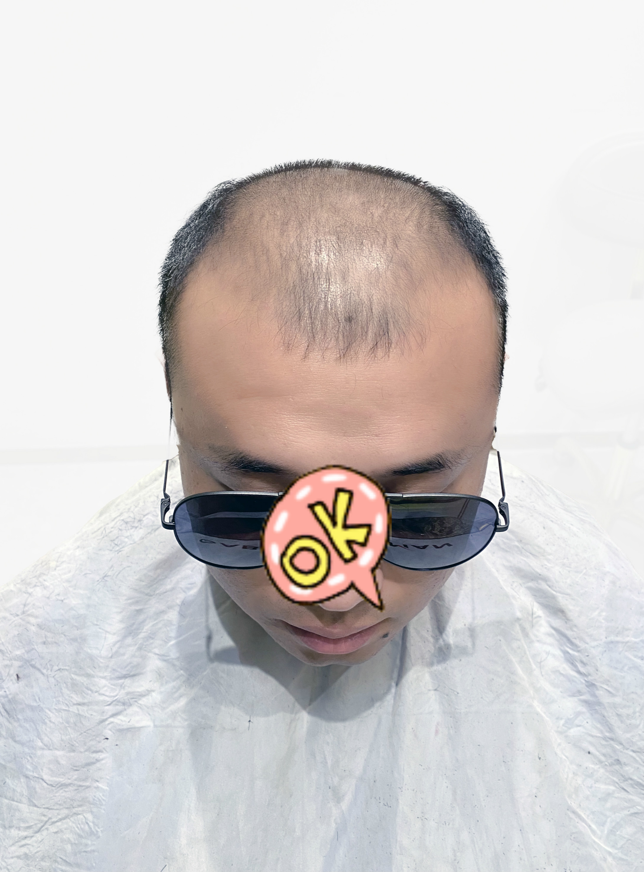 真人|假发为啥要选真人发?原来还能做这些发型,长见识了!