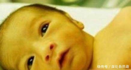 一生|影响宝贝一生的疾病,其实刚出生就能查出来!