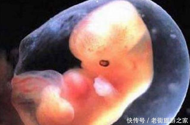 准妈妈|孕期做到“4不碰”，有利于保持羊水“清澈”，胎儿住着更干净