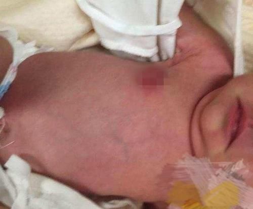 鼻梁|新生儿出生7天哭闹不停,宝妈掀开衣服一看,是婆婆动了“手脚”