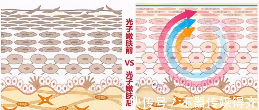 护肤|秋季适合做哪些医美护肤项目