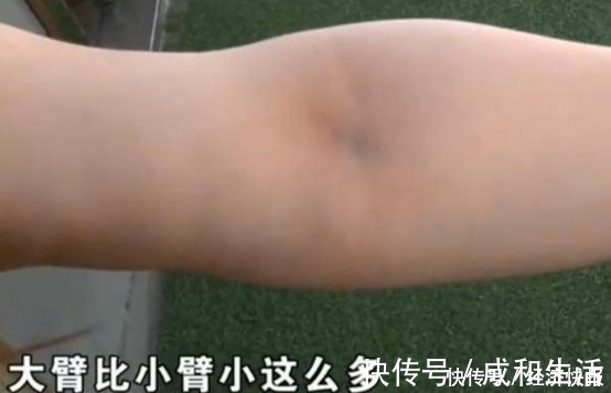 假体|女子高价整容，脸上挂满“注射器”，医院：赔你点吧