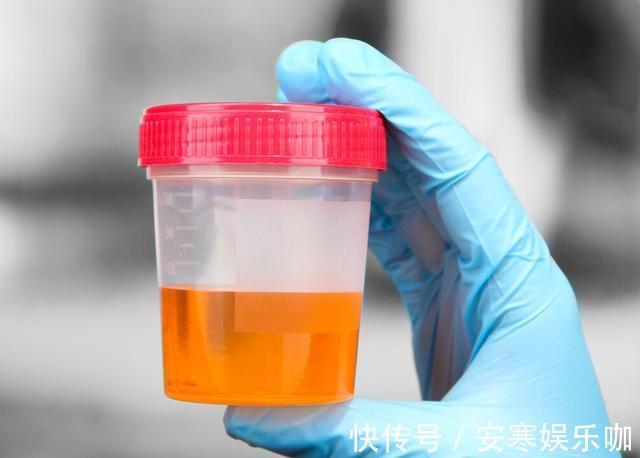 肝脏|女子误以为过敏,被查出肝癌,医生:身体3种“异常”,快查肝CT