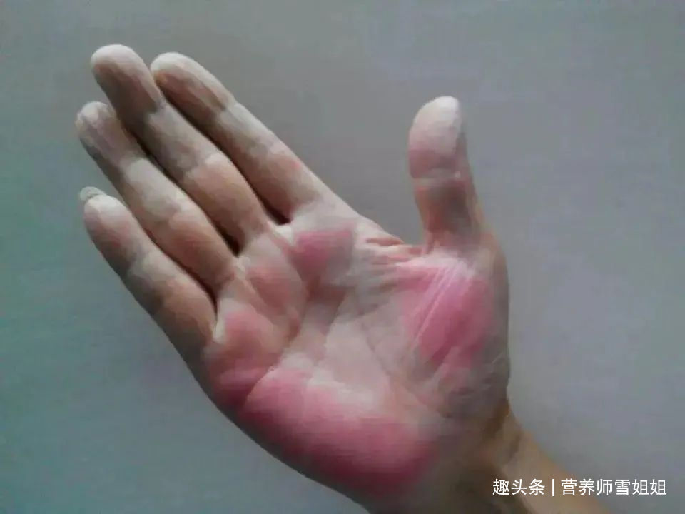 代茶饮|肝不好的人，手脚会有5种表现，若一个不占，恭喜你，肝脏很健康