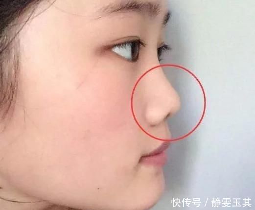 青春期女孩“贼伤鼻子”的3大行为,自认为很舒服,难怪异性缘会归0