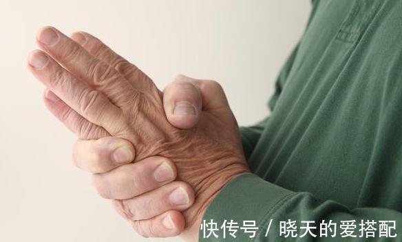 肚回弹|46岁男子,不痛不痒,查出肺癌,手上1个异常,提示已到中晚期!