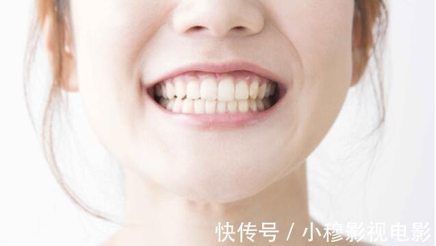 气血|肝病偷袭，“嘴”先报告，4个症状一目了然，希望你一个不占